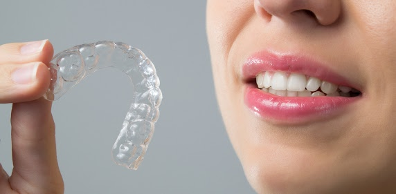 Are Clear Aligners Right for Me?