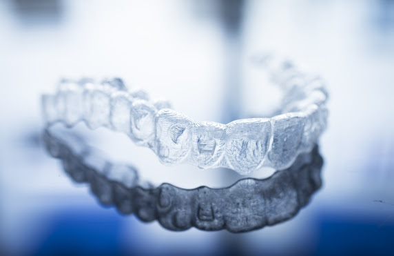 Should I Get Clear Aligners From a Dentist or Orthodontist?