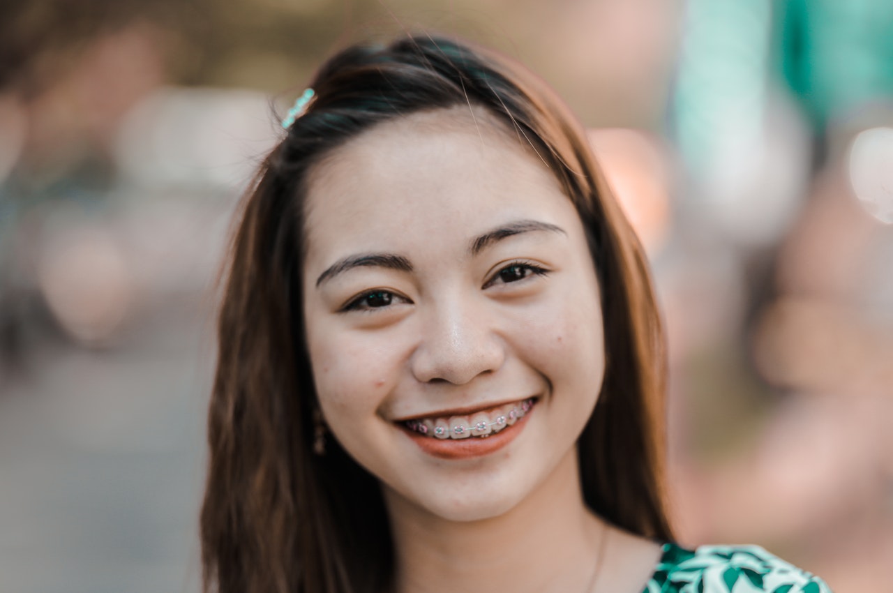 How to Care for Your Teeth with Braces