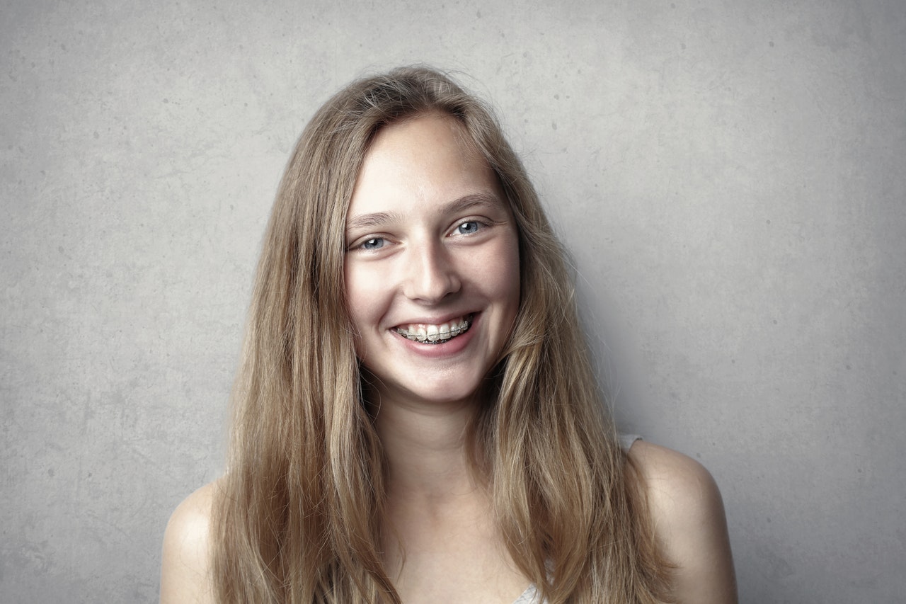 3 Things to Do Before Getting Braces