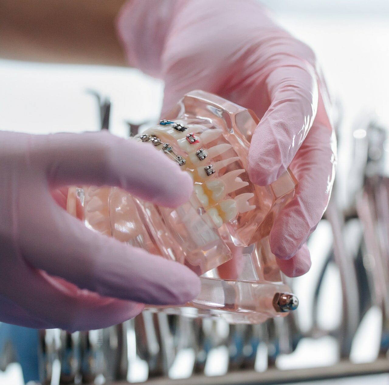 3 Common Signs You Might Need Braces