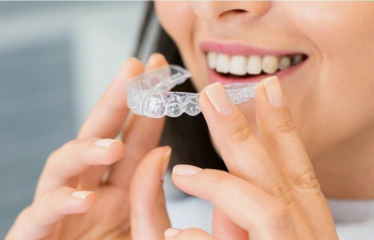 Invisalign Vs. Braces Difference to Know Sonneveld Orthodontics