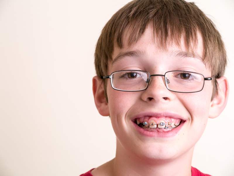 A Comprehensive Guide to Oral Hygiene with Braces for Kids