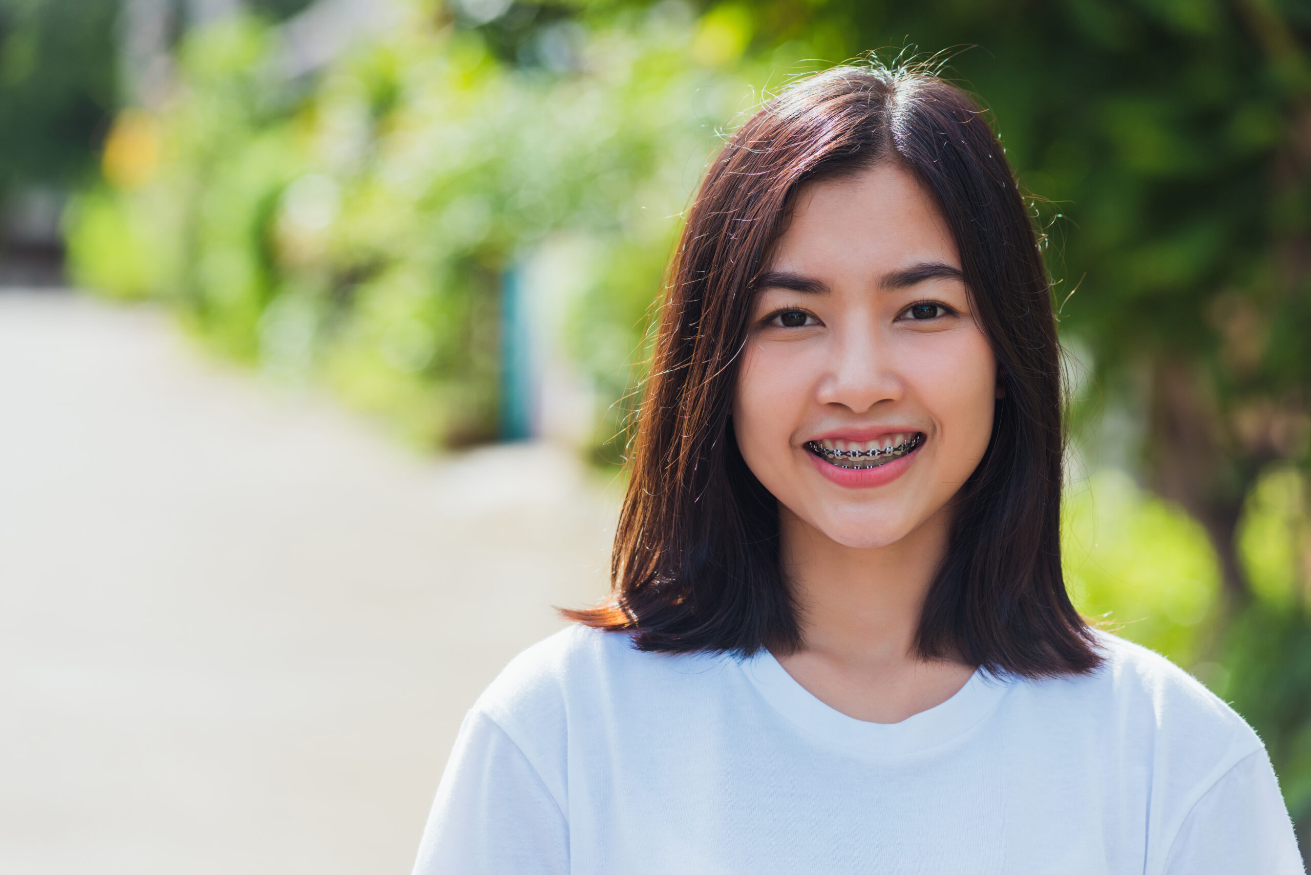 Summer Is the Best Time to Start Braces: Here Is Why Parents Choose May Through July
